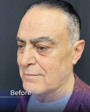 Slider image (6) Boroyan Plastic Surgery in Yerevan Armenia